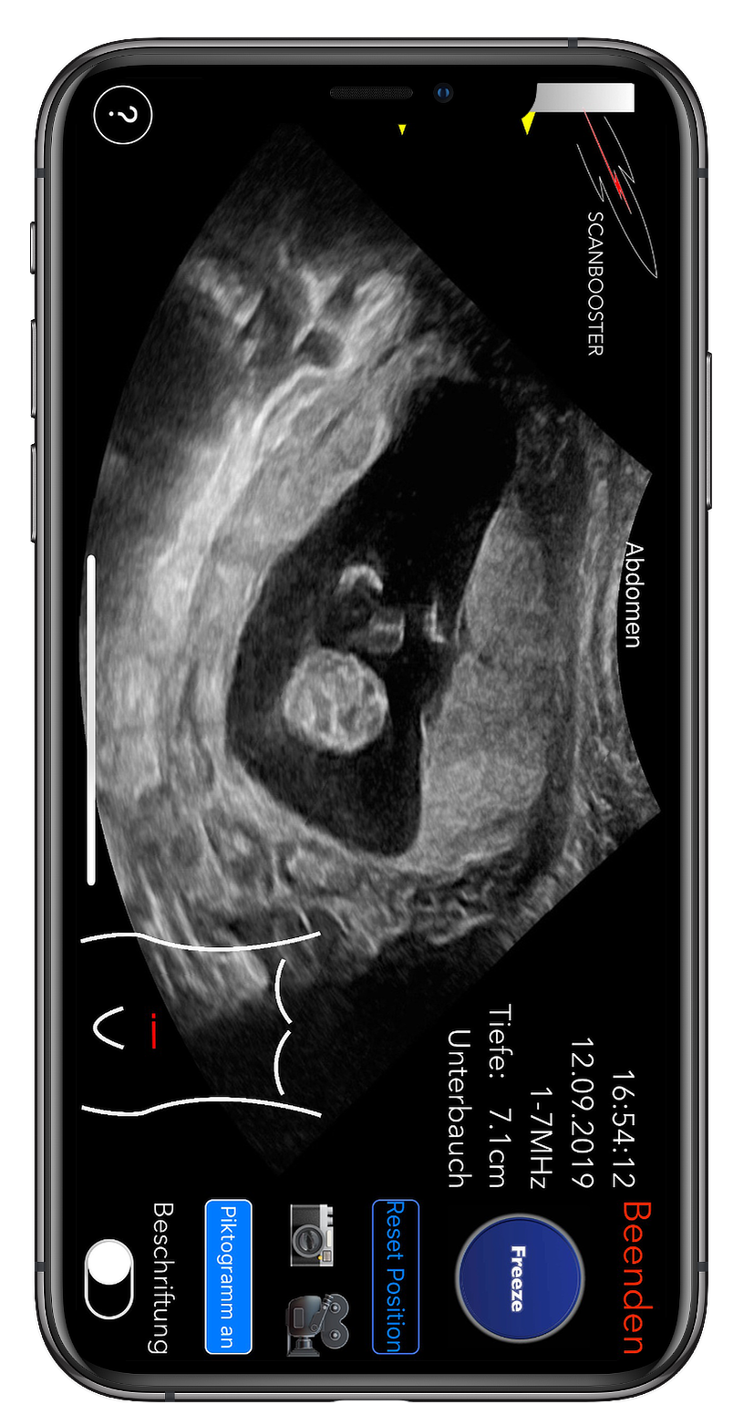 How to perform an ultrasound exam - look no further: Scanbooster is the world